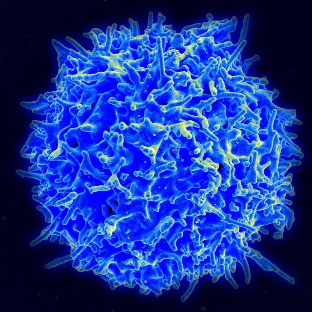 シグナルの入れ違いでCD4T細胞が機能麻痺。がん免疫療法の改善なるか？