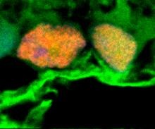幹細胞エキソソームが網膜神経節細胞の生存を高める｡緑内障治療にも応用可能か