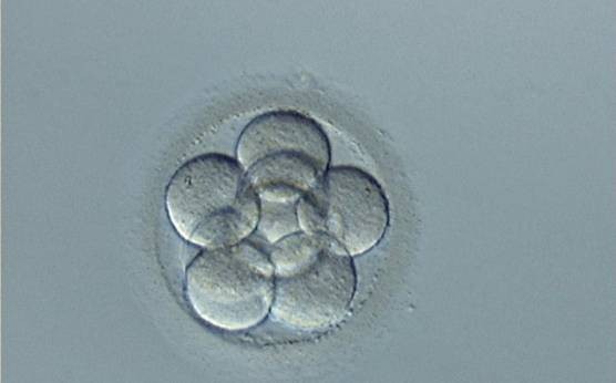 ヒト胚のゲノム発現を活性化する重要な転写因子（Oct-4）を発見
