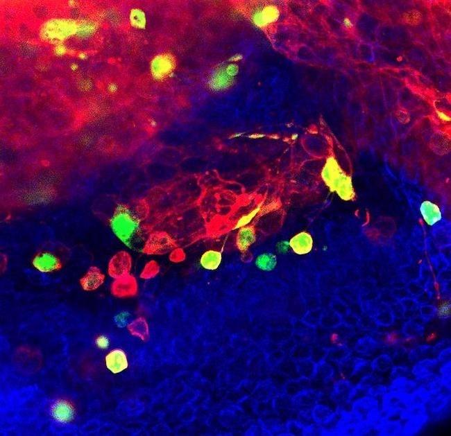 がん細胞の染色体の不安定性がDNA損傷を引き起こし、カスパーゼ活性を通じて侵入性を促進することが明らかに。