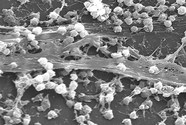バクテリアは電波に匹敵する化学シグナルを使ってコミュニティを形成することが判明