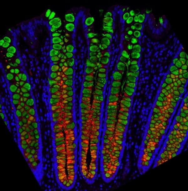 ヒトの腸管上皮全体を単一細胞の分解能で描画し、腸の健康状態をより正確により高い解像度で探ることに成功
