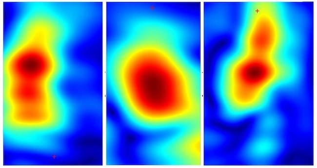 ミリ波イメージングを活用し、皮膚癌を数秒で発見できる低価格携帯端末を開発