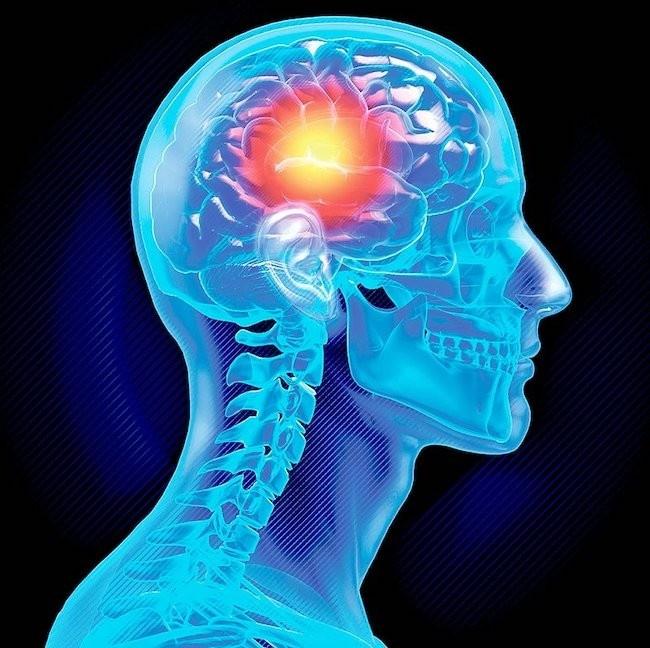 血液中の糖鎖分子がアルツハイマー病の予知に役立つことが判明