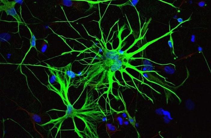 アルツハイマー病の発症の個人差に迫る─ピッツバーグ大学の研究者がアストロサイトの役割を明らかに