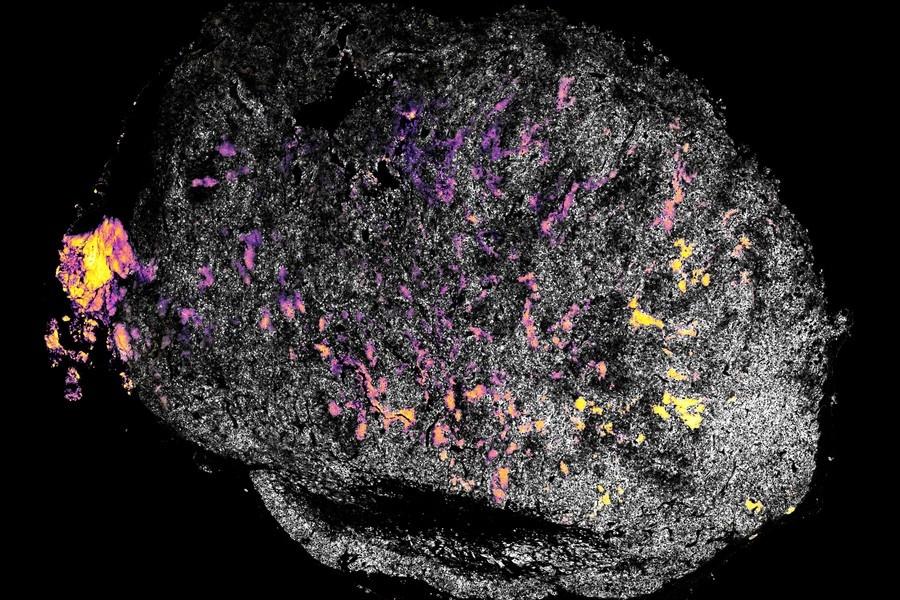 免疫系を刺激する薬剤で癌免疫療法が強化される可能性が報告された