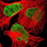 動物モデルで同じ遺伝子が乳がん抑制と心臓の健康増進に有効