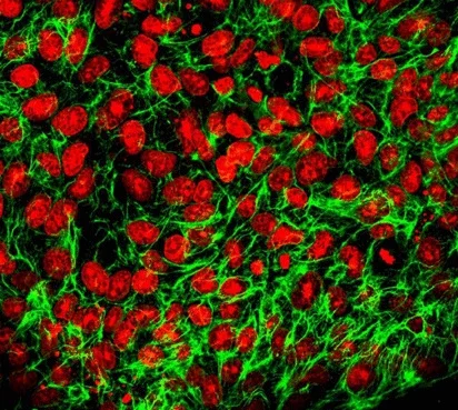 免疫療法抵抗性腫瘍はリンパ節に移動して免疫細胞活性化を遠隔的に阻害するPD-L1が詰まったエクソソームを輸送することが発見された 