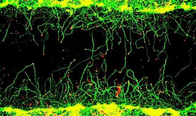 タンパク質間相互作用を安定化する天然分子が軸索再生を刺激。脊髄損傷や卒中の標的候補になり得るか？