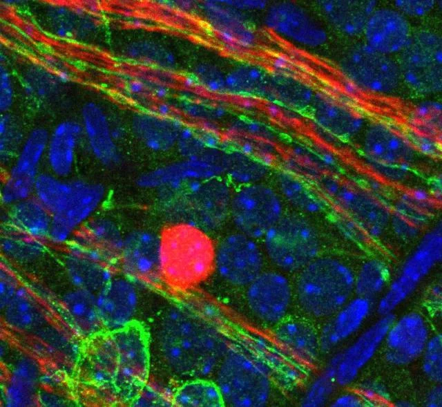 眼の血管の発達を調節する光依存性分子パスウェイが発見された。未熟児網膜症と近視の未熟児の治療に光線療法の可能性を示す。 