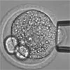 IVF受精卵の柔らかさで胚生存率を予測し単一胚移植の成功率を向上