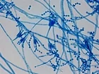 LC-MS/MSを用いて真菌のロイシノスタチンを発見