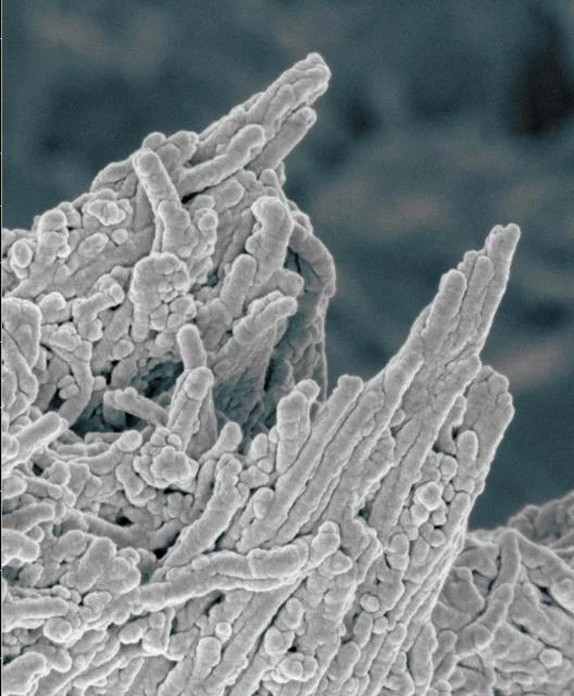 既存のニキビ薬（ミノサイクリン）が動脈硬化の予防・治療に非常に有効であることが判明