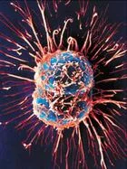 Dr. Vogelstein他の研究で、がんリスクの多くが幹細胞分裂に伴う突然変異と関連。がんの3分の2は｢不運｣、3分の1は環境と遺伝が主因