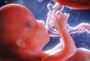非侵襲的な、母親の血液解析によって、胎児の遺伝子情報を得る