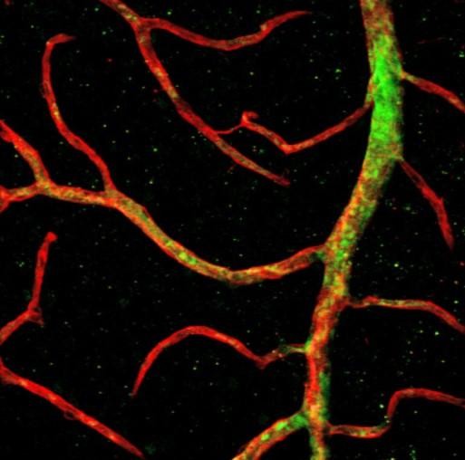 『原始的な』幹細胞による糖尿病性網膜症の目の血管の再生医療技術に進歩