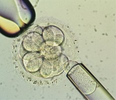 シャルコー・マリー・ツース胚由来の幹細胞株を用いた研究に脚光