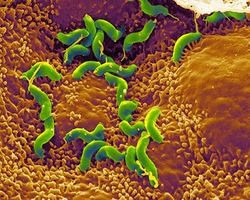 H.ピロリ菌が胃の中の酸性環境からどうやって逃げているのか−原子結晶構造解析で判明