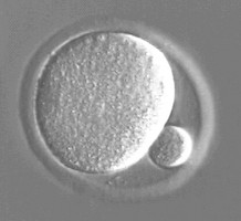 エピジェネティック・マーカーの安定に必須である卵子タンパクがみつかる