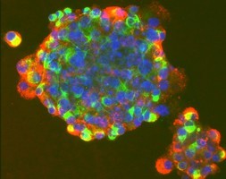 成体幹細胞、ヒトの腸組織から分離