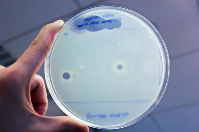 ヒトマイクロバイオームのゲノムデータから新しい抗生物質を発見