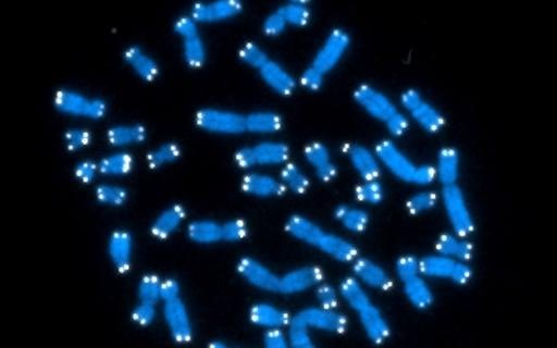 テロメラーゼの新たな役割が明らかに。テロメラーゼは正常細胞の細胞死の直前に一過性誘導され、より緩やかな細胞死をもたらす。