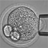 IVF受精卵の柔らかさで胚生存率を予測し単一胚移植の成功率を向上