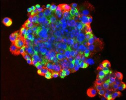 肺再生をもたらす幹細胞が発見される