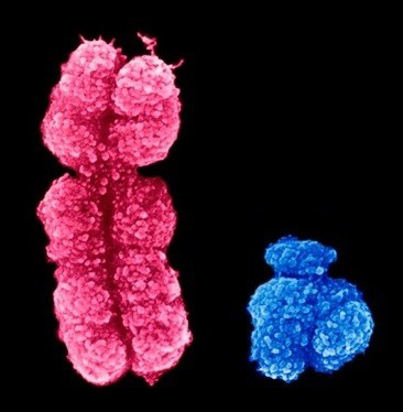 ヒトY染色体遺伝子によって制御される非性器機能が発見された。なぜ特定の病気が男性と女性に異なる影響を与えるのか？その理由を解明できるかもしれない。
