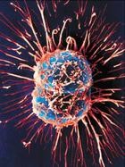Dr. Vogelstein他の研究で、がんリスクの多くが幹細胞分裂に伴う突然変異と関連。がんの3分の2は｢不運｣、3分の1は環境と遺伝が主因