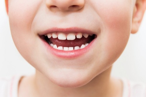 小児期の『歯』にALSのバイオマーカーがあることが発見された