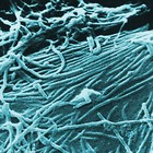 エボラ・ウイルスが免疫系を阻害する仕組み解明近づく