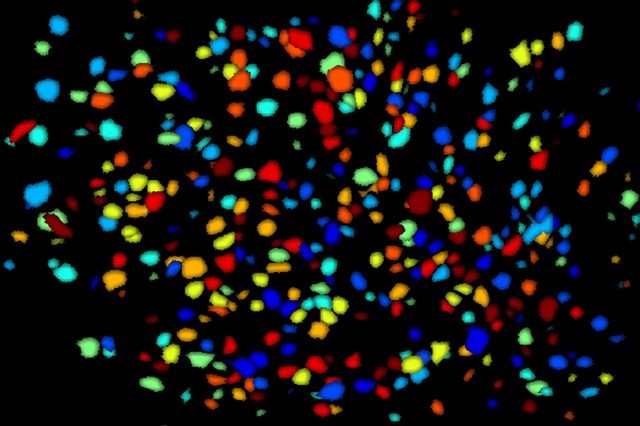 ニューロン活動を撮影する超小型頭部埋込蛍光顕微鏡開発にNIHが230万ドルの助成金