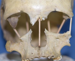 3万5千年前のヒト女性頭骨（Peştera Muierii 1）の全ゲノムの解読に成功。ヒトの遺伝的多様性が最も失われた時期を示唆。