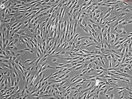 細胞外小胞に含まれる因子を含む間葉系間質細胞からの分泌因子が、メチシリン耐性黄色ブドウ球菌スーパーバグによる感染症の治療に有望であることが示された