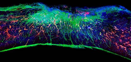 “踊る分子”で重度の脊髄損傷の修復に成功。生体分子の動きを模倣した短い修飾ペプチドを単回注射したところ、麻痺した動物が4週間で歩く能力を取り戻した。