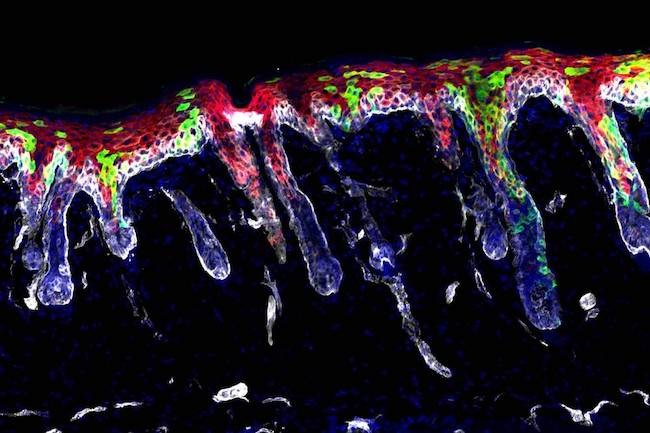 幹細胞の記憶が創傷修復と慢性疾患を促進する可能性がロックフェラー大学の新研究で証明された