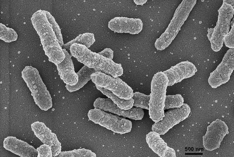 ペスト菌が免疫システムを回避するメカニズムの解明に挑む