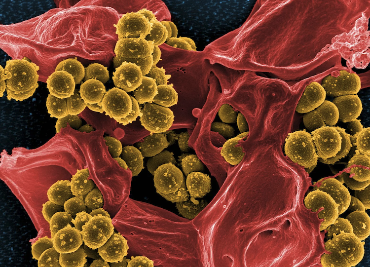 抗生物質が効かない時代の救世主？薬剤耐性菌に有効な新物質「インフュージド」を開発