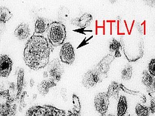 HTLV-1感染症に光明！既存のHIV治療薬が感染予防に有効であることを発見