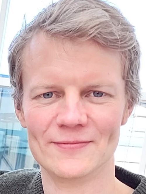 細胞内の「分子ストップウォッチ」を発見！mRNAテールの長さを時間で測る新メカニズム