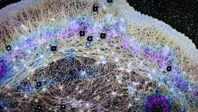 がん転移の謎を解く？ 細胞内の「風」がタンパク質を運ぶ新発見