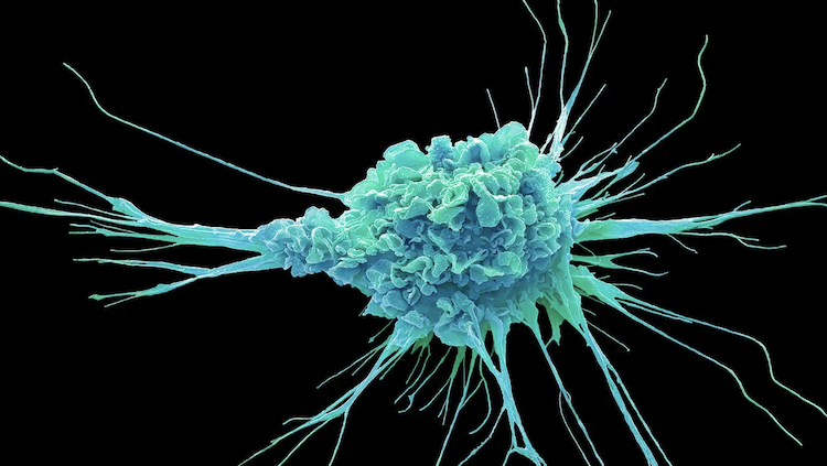 免疫応答を自在に操る？次世代ワクチン開発の鍵はLNPにあり