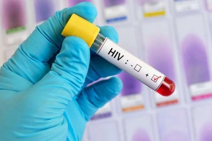 HIV感染を防ぐ鍵？VNPが示す免疫メカニズムの新発見