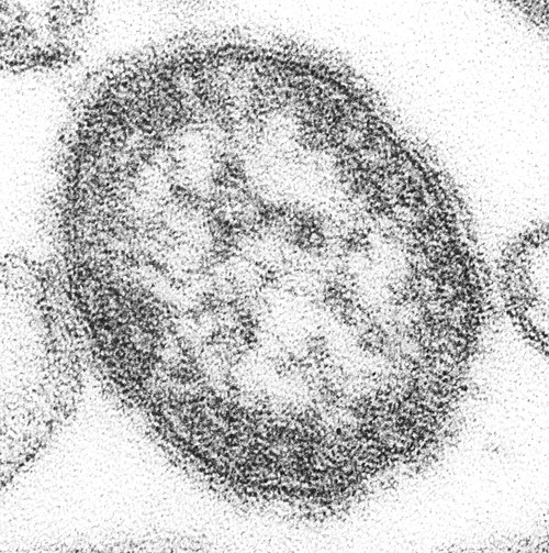 森に潜む新たな脅威：麻疹に似たウイルスが種を超えて伝播する仕組みを解明