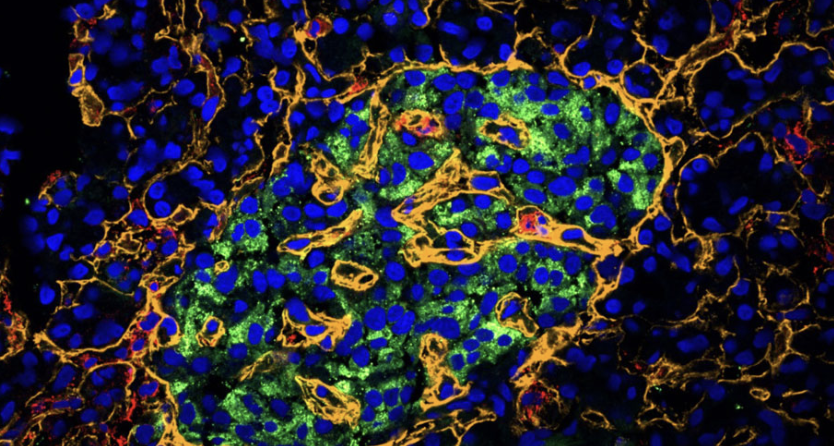 膵臓の「平和維持部隊」を発見：1型糖尿病治療を変える血管関連線維芽細胞（VAFs）とは