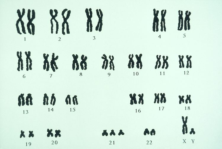 シングルセル解析が明らかにしたダウン症胎児の血液細胞発生の異常