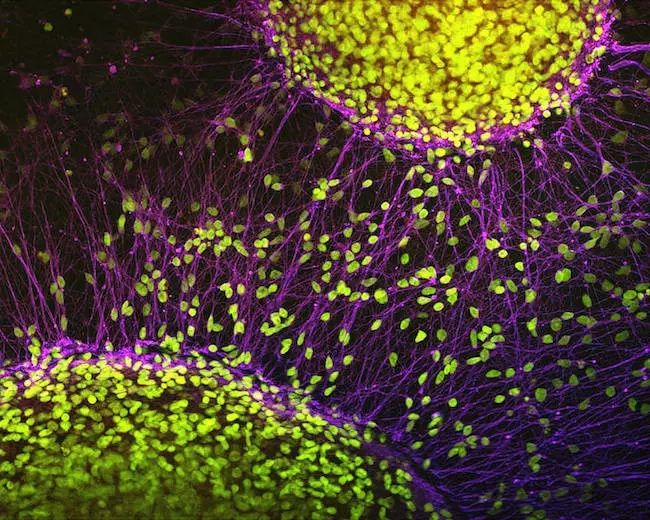 新技術で脳細胞の老化を追跡：脳の老化プロセスを理解する新たな手段