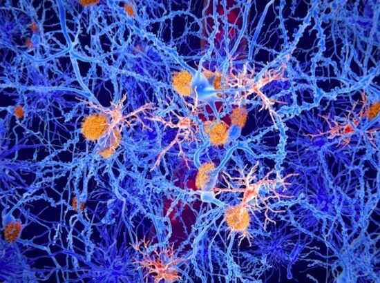 脳内免疫細胞（ミクログリア）の重要なシグナル伝達経路がアルツハイマー病治療の新たなターゲットになる可能性を発見