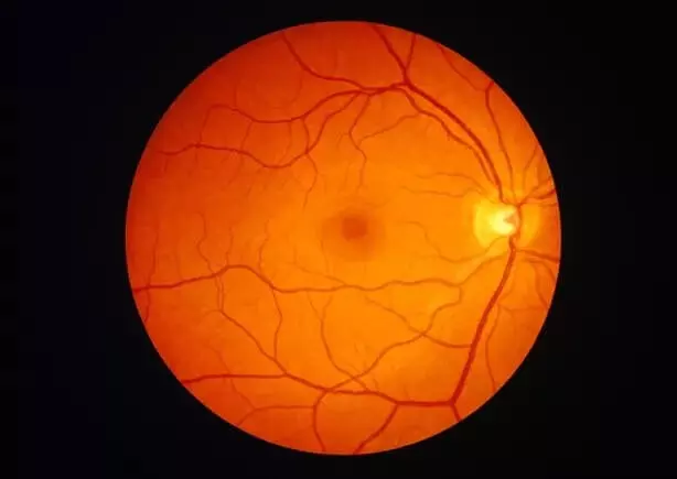 ヒト網膜色素上皮の単一細胞マップが失明疾患の正確な治療法を進展させる可能性